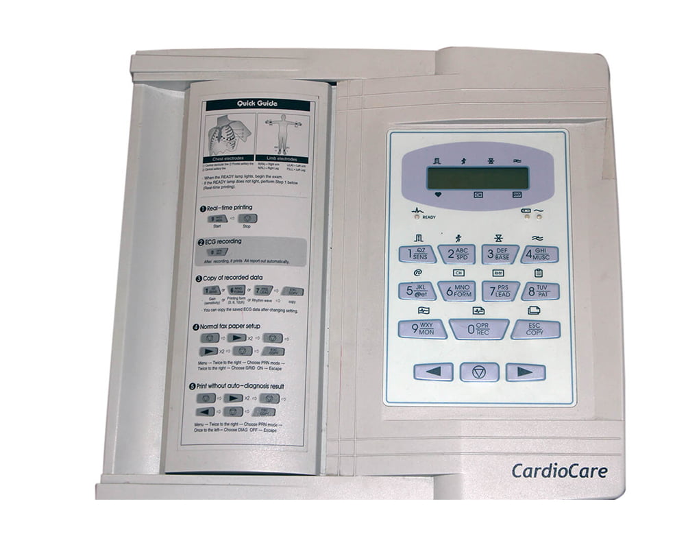 Širdies elektrokardiograma
