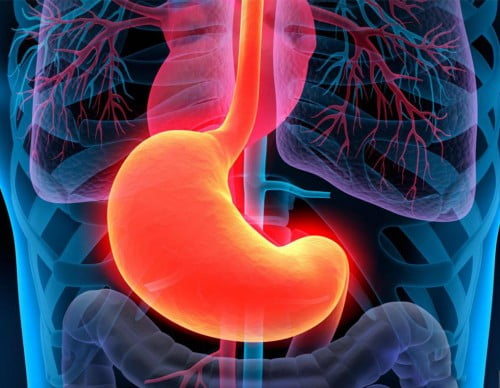 Neinvazinė diagnostika UBT Helicobacter Pylori bakterijai nustatyti