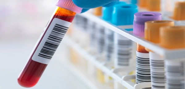 Laboratoriniai tyrimai